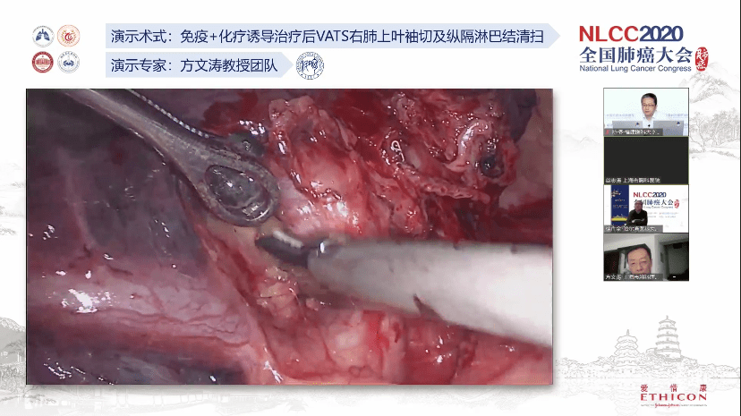 全国最新肺研究动态及其深远影响